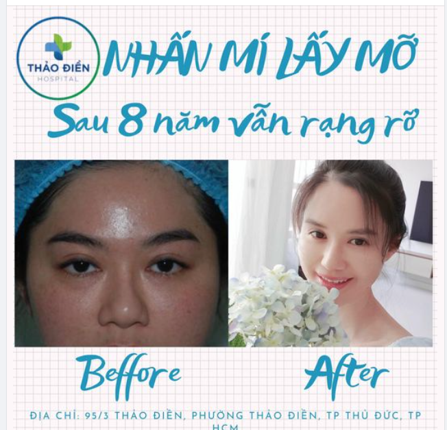 NHẤN MÍ LẤY MỠ SAU 8 VẪN RẠNG RỠ