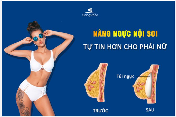 NÂNG NGỰC NỘI SOI - SAU BAO LÂU THÌ NGỰC MỀM ĐẸP?