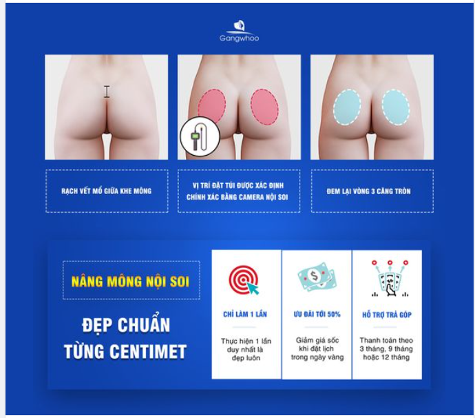 NÂNG MÔNG NỘI SOI - LÀM 1 LẦN ĐẸP CHUẨN TỪNG CENTIMET