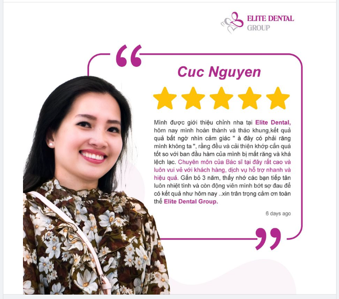 NIỀNG RĂNG KHI BỊ MẤT RĂNG VÀ CÁI KẾT......