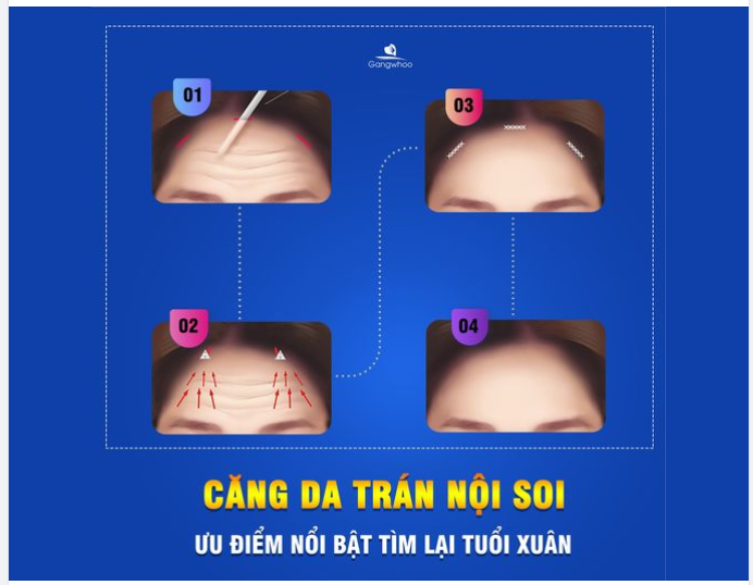 DA TRÁN NHĂN NHEO LÀM BẠN GIÀ ĐI - CĂNG DA TRÁN NỘI SOI SẼ GIÚP BẠN
