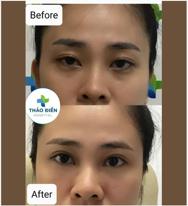 CÓ NGÀY EM THẤY BUỒN HIU GHÉ ĐÂY LÀM ĐẸP CHO ĐỜI THÊM VUI