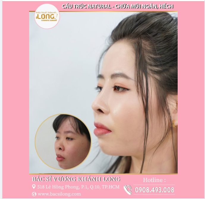 NHAN SẮC TỪ BÌNH THƯỜNG TRỞ NÊN KHÁC THƯỜNG