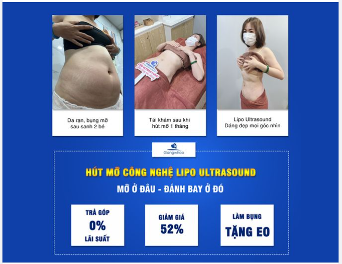 SAU SINH NỞ, CHỊ EM KHỔ SỞ VÌ MỠ THỪA THẾ NÀO?
