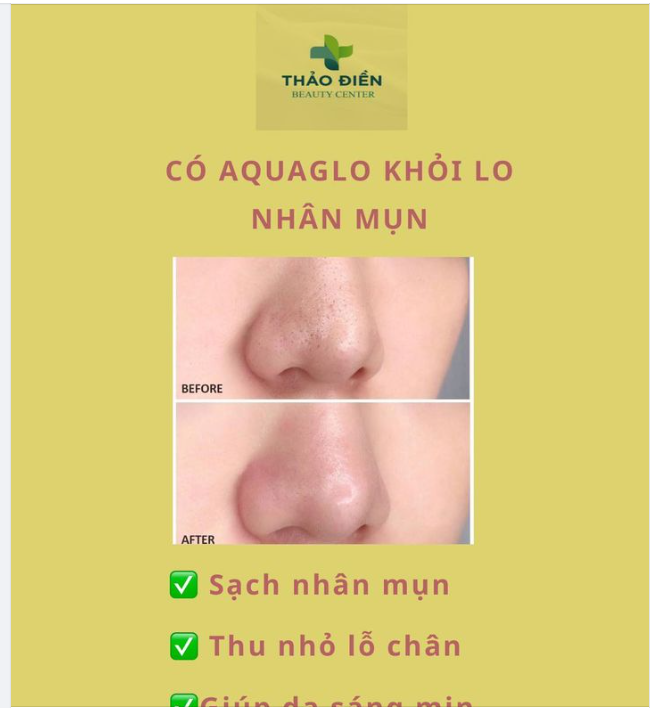 CÓ AQUAGLO KHỎI LO NHÂN MỤN - DA TRẮNG SÁNG THÊM MỊN MÀNG
