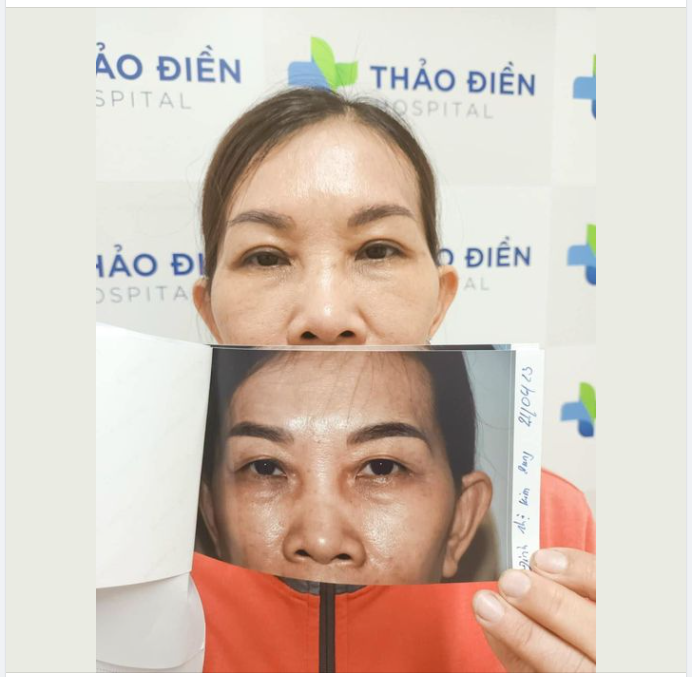 DÙ LÀ ĐANG Ở ĐỘ TUỔI NÀO, MỌI NGƯỜI VẪN CÓ THỂ CẢI THIỆN LẠI NHAN SẮC CHO CHÍNH MÌNH