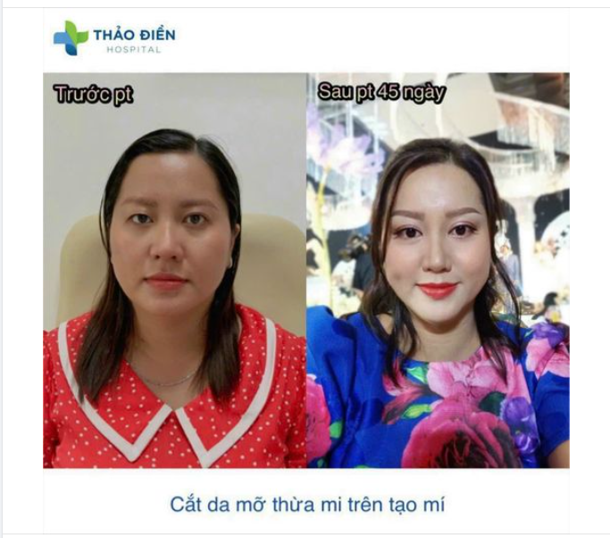 Bạn đã biết Top những Bệnh viện cắt mắt nổi tiếng ở sài gòn chưa?