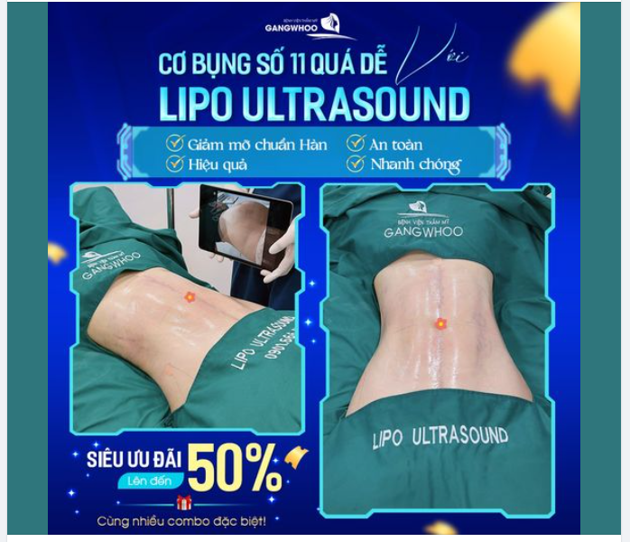 LIPO ULTRASOUND - DÁNG SIÊU MỠ CŨNG HÓA ĐỒNG HỒ CÁT