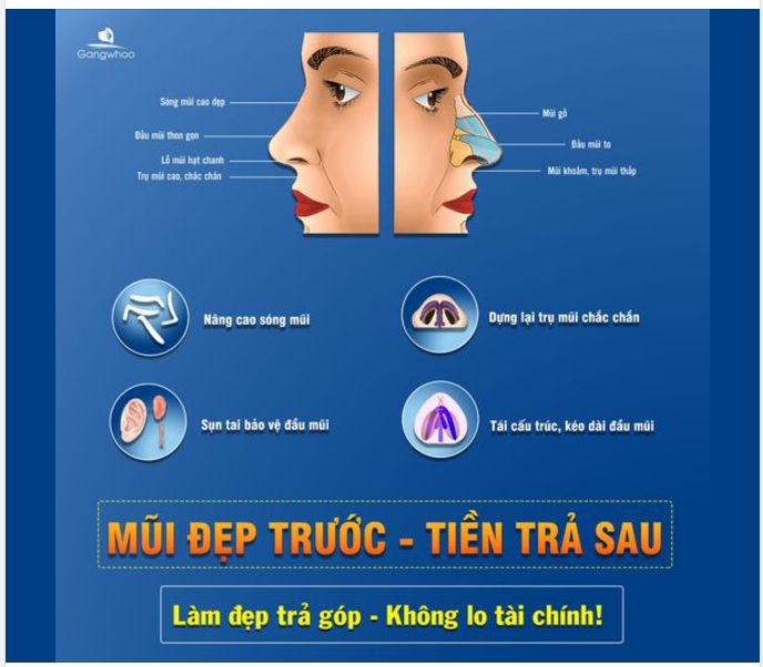 NHỮNG LƯU Ý VÀNG KHI NÂNG MŨI BẠN CẦN BIẾT!