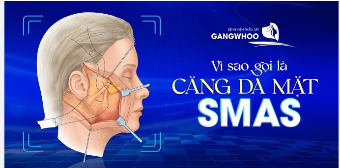 VÌ SAO GỌI LÀ CĂNG SA MẶT SMAS?