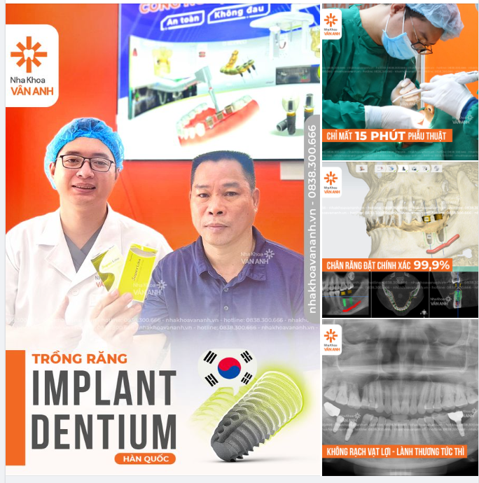 Trồng Răng Implant Chất Lượng và An Toàn - Công nghệ Hi-Safe Nha Khoa Vân Anh sẽ giúp khách hàng