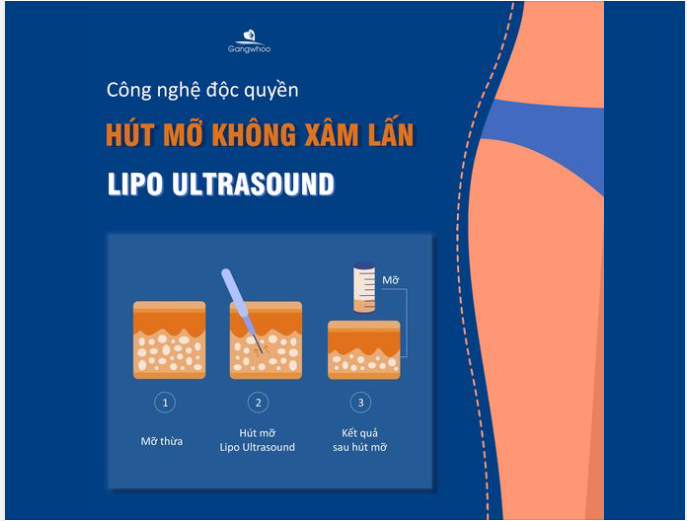 VÌ SAO BẠN NÊN CHỌN HÚT MỠ LIPO ULTRASOUND?