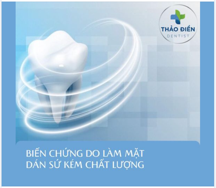 BIẾN CHỨNG DO LÀM MẶT DÁN SỨ KÉM CHẤT LƯỢNG