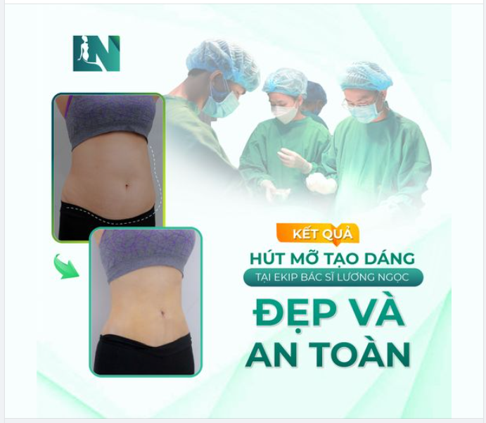 Lựa chọn hút mỡ là kết quả phải đẹp và an toàn