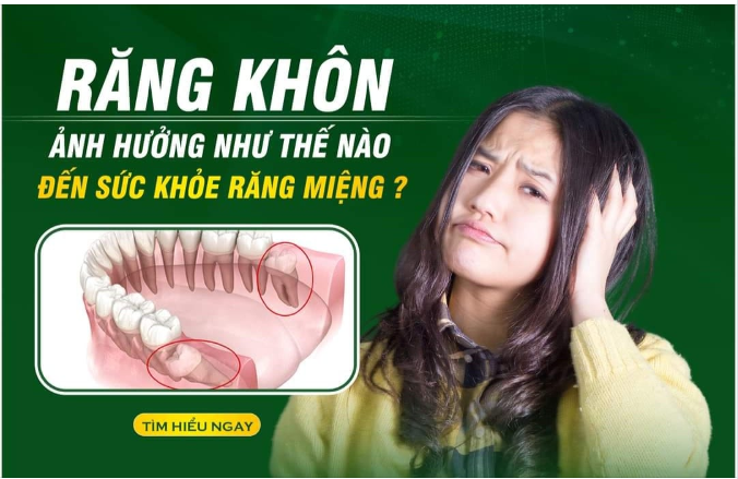 RĂNG KHÔN ẢNH HƯỞNG NHƯ THẾ NÀO ĐẾN SỨC KHỎE RĂNG MIỆNG?