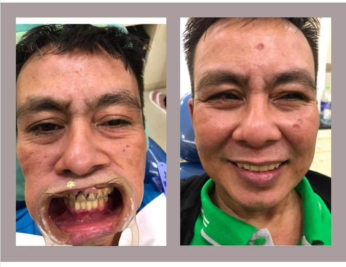 Niềm vui hạnh phúc của bạn về nụ cười là niềm tự hào của chúng tôi !