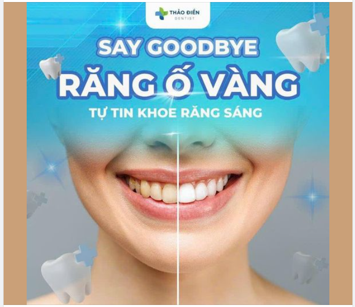 SAY GOODBYE RĂNG Ố VÀNG - TỰ TIN KHOE RĂNG TRẮNG SÁNG