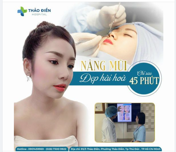 NÂNG MŨI CAO TÂY - CHỈ SAU 45 PHÚT
