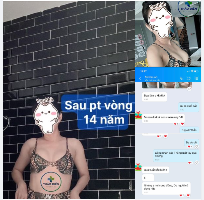 Nâng Ngực sau 14 năm auto thế nào??