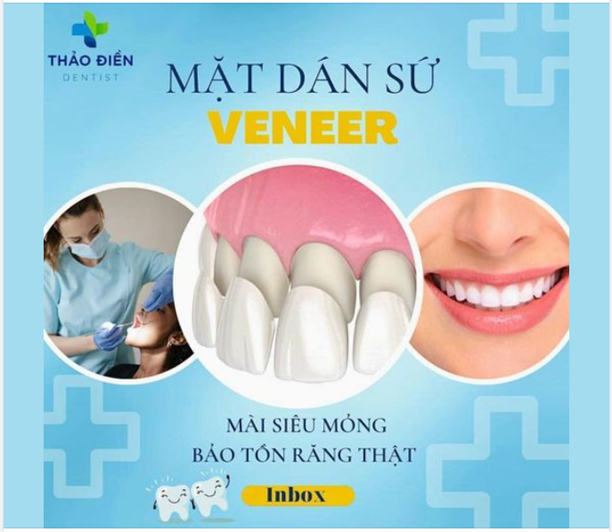MẶT DÁN SỨ VENEER - BẢO TỒN TỐI ĐA RĂNG THẬT