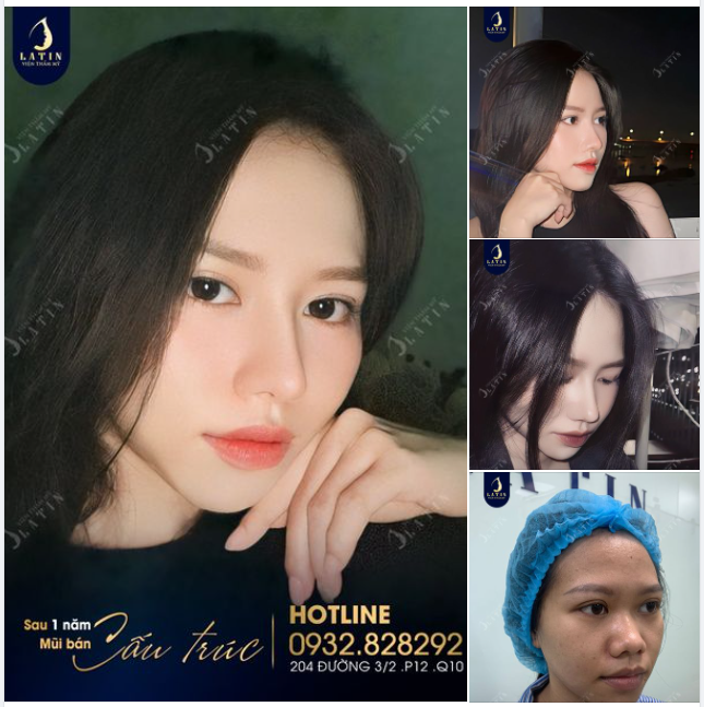 Bí quyết để trở nên xinh đẹp, tự nhiên như bây giờ của em là gì?