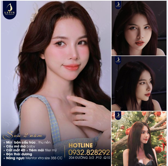 Sau 2 năm làm nhiều dịch vụ làm đẹp, TM ngày càng tự tin và gặp nhiều may mắn hơn với nhan sắc đỉnh cao của mình