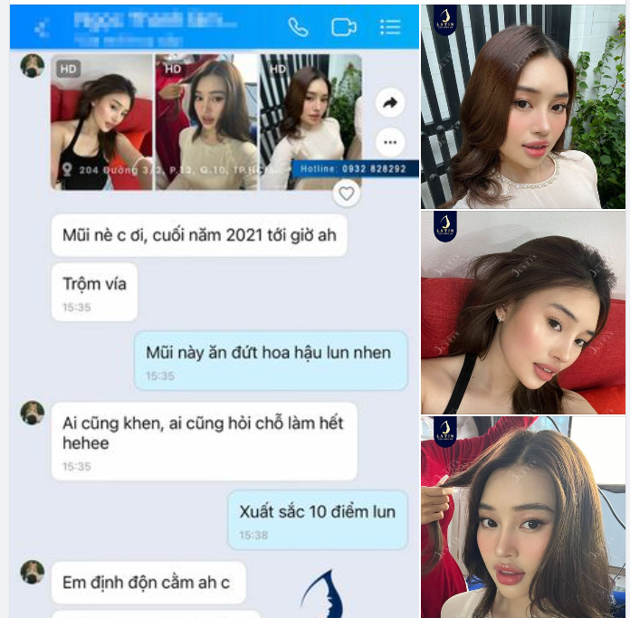 Visual cỡ này đủ debut làm idol luôn rồi đó ạ. Feedback mũi cấu trúc 2 năm từ em gái xinh đẹp