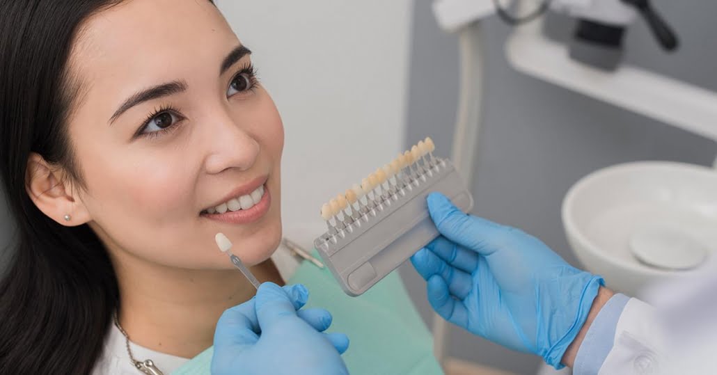 Dán sứ Veneer là gì? Giá bao nhiêu? Dán sứ ở đâu an toàn và chất lượng?