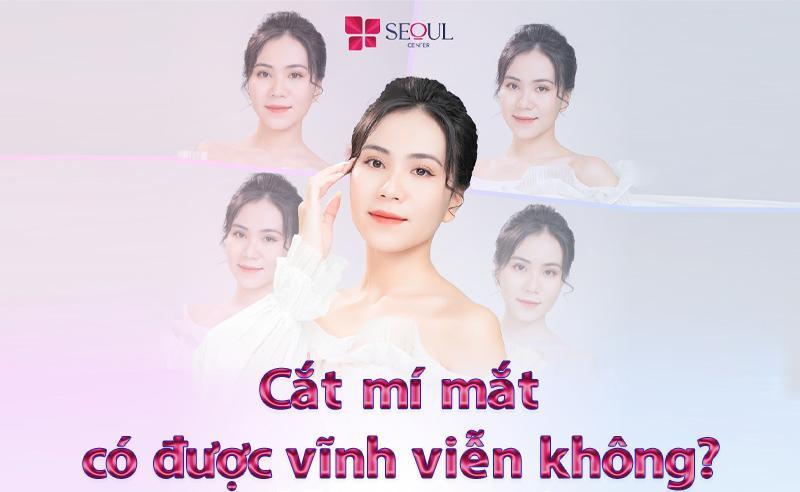 Cắt mí mắt có được vĩnh viễn không?Kinh nghiệm giữ nếp mí lâu dài