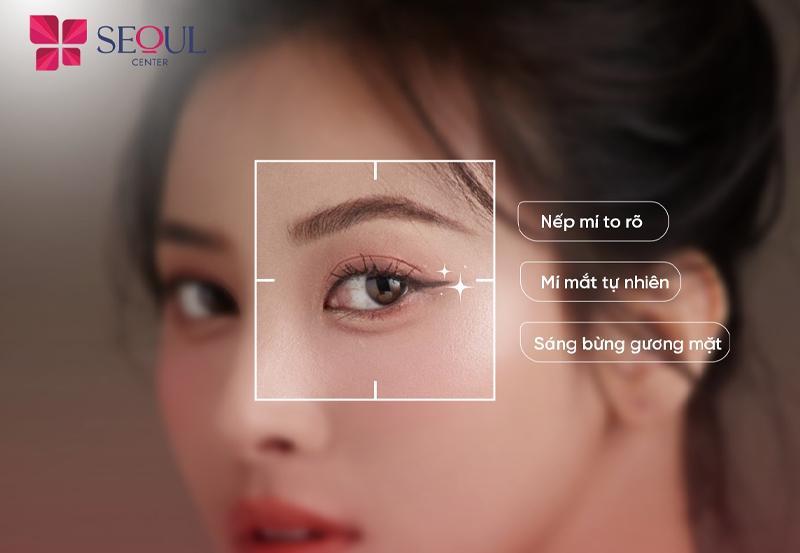  Cắt mí giúp bạn sở hữu đôi mắt sắc sảo, thu hút nhưng không duy trì hiệu quả vĩnh viễn