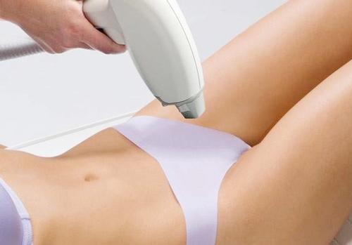 Chia sẻ kinh nghiệm triệt lông vĩnh viễn vùng kín có tốt không?