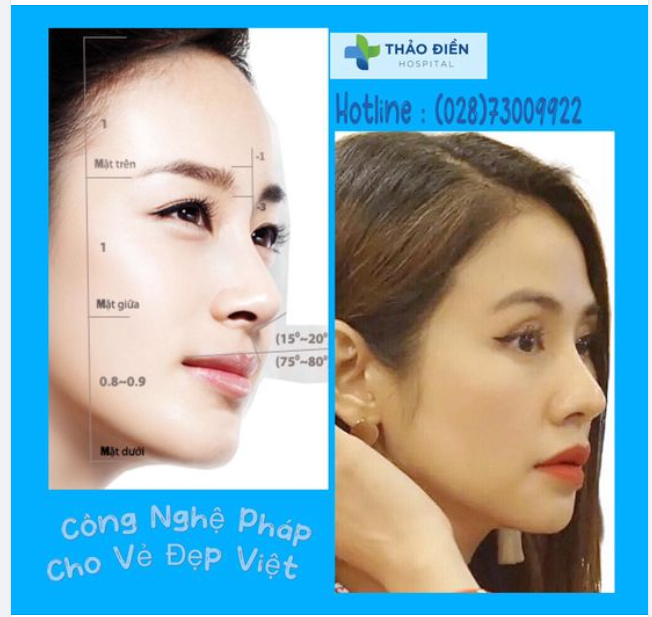 Nhân tướng học đã chỉ ra rằng, những người có chiếc mũi cao, thẳng, đầu mũi tròn trịa, cánh mũi thon gọn, lỗ mũi hình hạt chanh là đặc điểm của một chiếc mũi đẹp.
