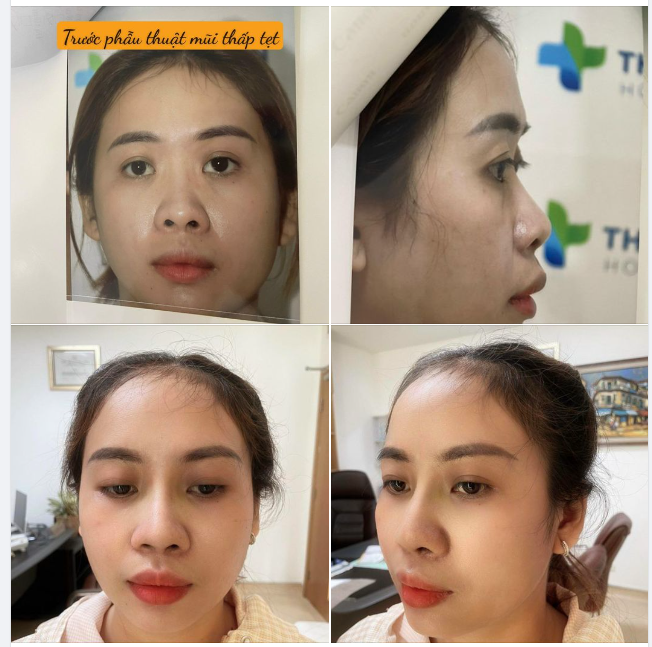Nắng vàng, trời xanh mà có tia cực tím. Em thì cực hiếm, phải tia thật nhanh
