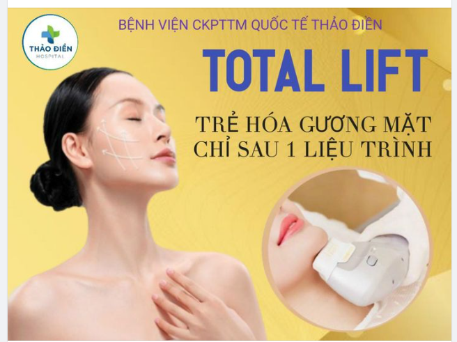 TOTAL LIFT TRẺ HÓA GƯƠNG MẶT SAU 1 LIỆU TRÌNH