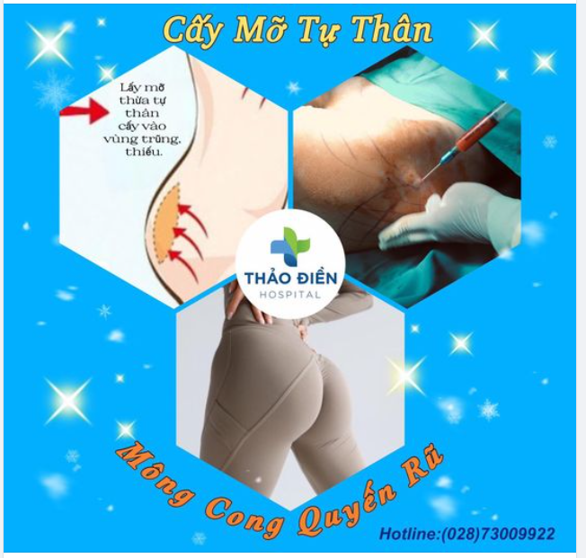 Sở hữu vòng 3 căng tròn là điều mà hẳn chị em nào cũng mong ước. Cấy mỡ mông được xem là phương pháp giúp cải thiện vòng 3 hiệu quả được các chị em tin tưởng lựa chọn.