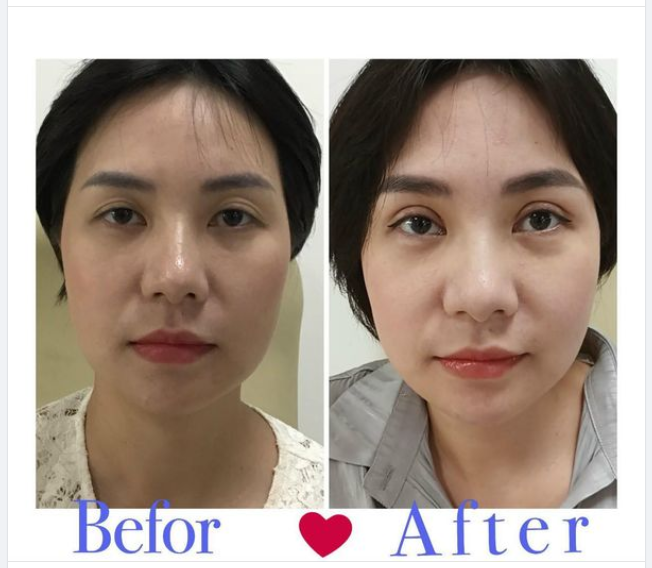 NỤ CƯỜI, SỰ HÀI LÒNG, CỦA KHÁCH HÀNG LÀ NIỀM VUI CỦA BỆNH VIỆN CKPTTM QUỐC TẾ THẢO ĐIỀN.