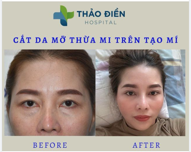 CÙNG THAY ĐỔI ĐỂ ĐÓN CHÀO NĂM MỚI VỚI MAY MẮN NGẬP TRÀN CHO NÀNG THÊM XINH