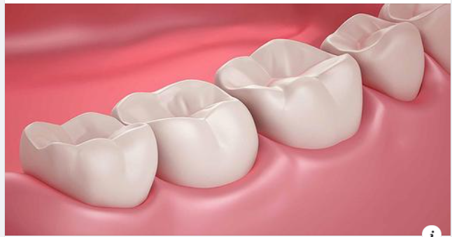 Trám Răng Có Cần Chích Thuốc Tê Không?