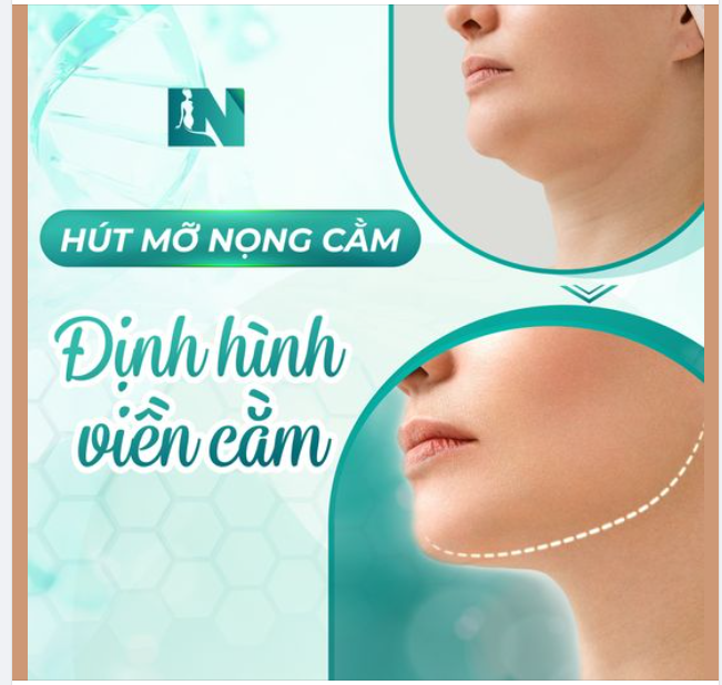 ĐÁNH BAY NỌNG MỠ, ĐỊNH HÌNH CẰM V-LINE CHUẨN HÀN
