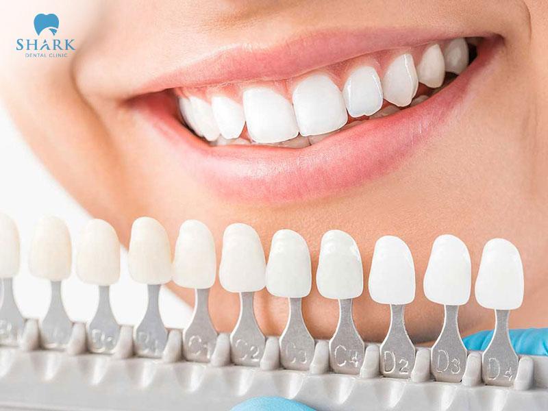 Bọc răng sứ giúp cải thiện tính thẩm mỹ, chức năng ăn nhai giống với răng thật