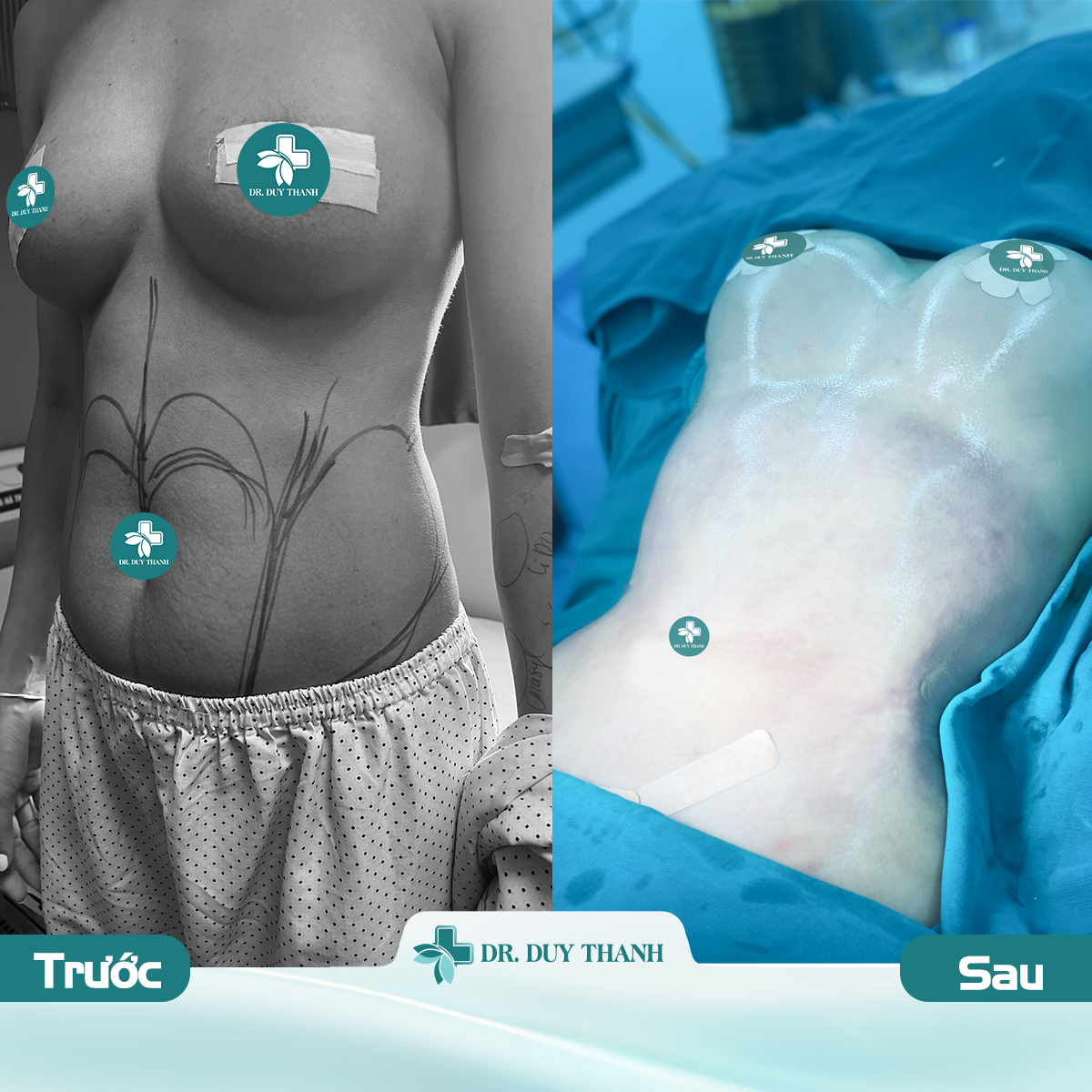 Đến với Dr Duy Thanh là đẹp không tì vết