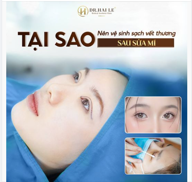 Chia tay mí lỗi hỏng đến ngay Dr.Hải Lê!