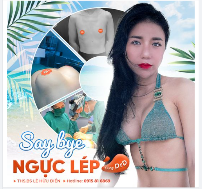 SAY BYE NGỰC LÉP TỰ TIN ĐÓN HÈ CÙNG DRD.