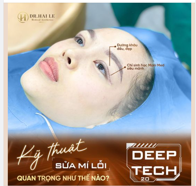 KỸ THUẬT SỬA MÍ LỖI HỎNG. QUAN TRỌNG NHƯ THẾ NÀO?