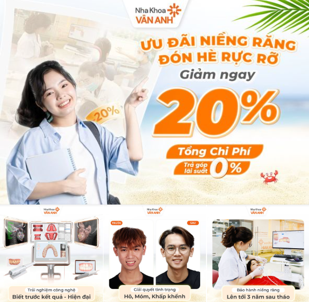 GIẢM 20% TỔNG CHI PHÍ NIỀNG RĂNG TẠI HÀ NỘI
