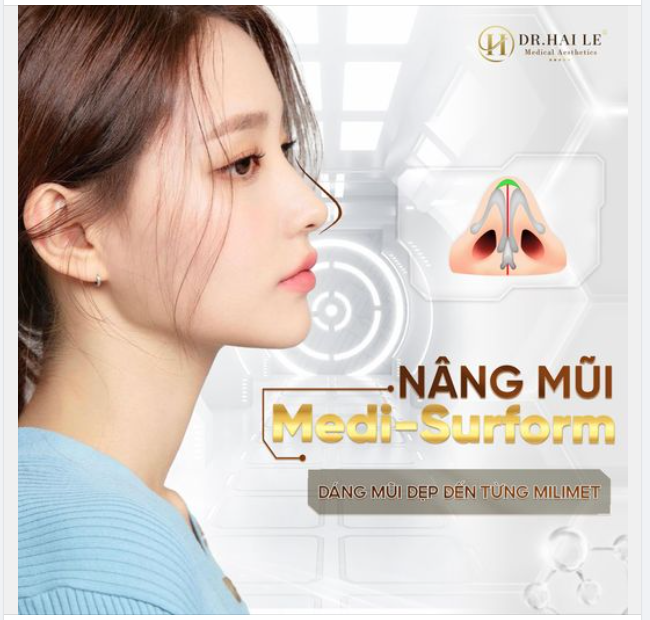 Medi - Surform chính là sự nâng cấp vượt trội từ hai dáng mũi rất thành công trước đó  của Dr.Hải Lê là Mediform và Demi Tech 6D.