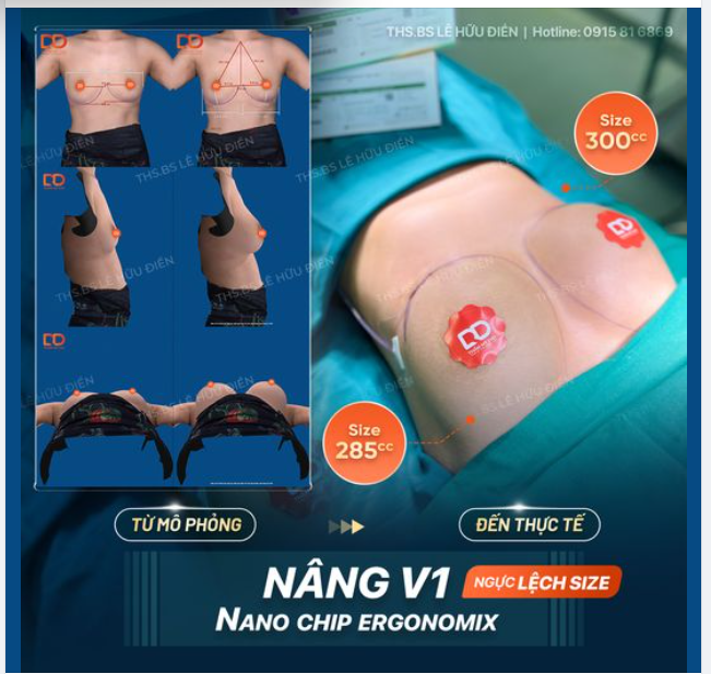 Từ mô phỏng đến thực tế. Từ CUP A đến CUP C dễ dàng sau 60 phút thực hiện.