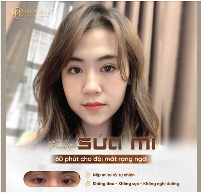Mí đẹp, mắt xinh - Lung linh tỏa sáng