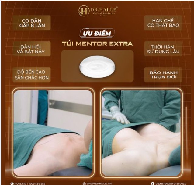 Mentor Extra - Dòng túi thế hệ mới