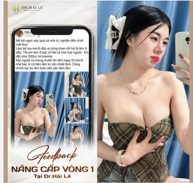 Và đây là kết quả sau 2 tháng nâng cấp vòng 1 tại Dr.Hải Lê! Tạm biệt vòng 1 teo lép, Dr.Hải Lê sẽ giúp chị em tự tin tỏa sáng cùng đôi "gò bồng đào" căng đầy, tròn trịa!